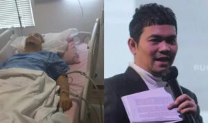 Indra Bekti Selesai Jalani Operasi Pendarahan Otak, Belum Sadar dan Masih di ICU
