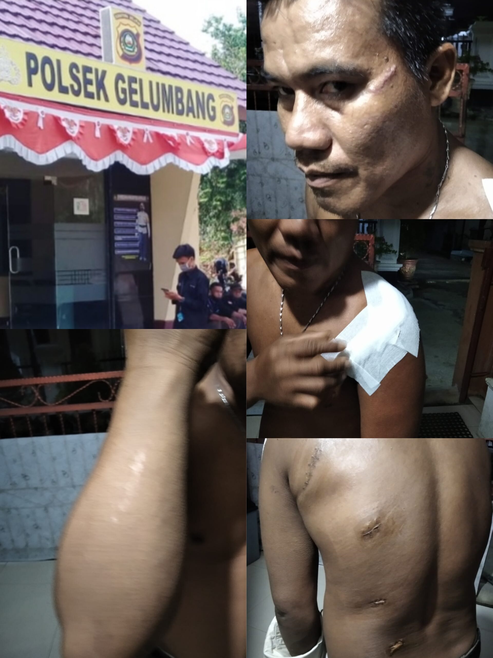 "Kaburnya Terlapor Tindak Pidana Penganiayaan Berat Diduga Dikondisikan"