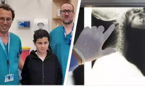 Dokter di Israel Berhasil Sambungkan Kembali Kepala Bocah yang Hampir Lepas karena Tertabrak Mobil