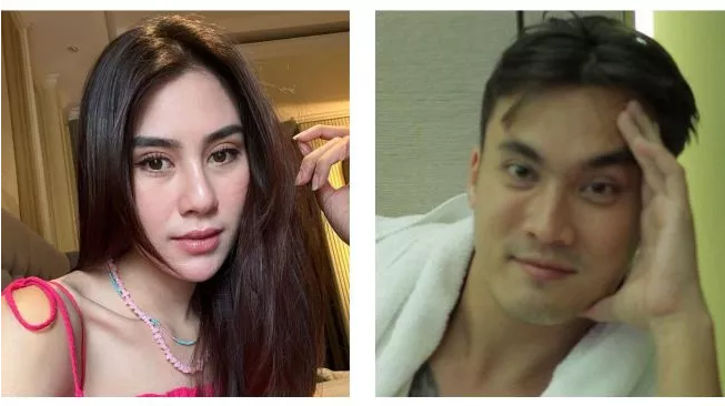 Akui Tato di Punggungnya Benar Wajah Syahnaz Sadiqah, Rendy Kjaernett: Gue Cuma Mikir ya Obat