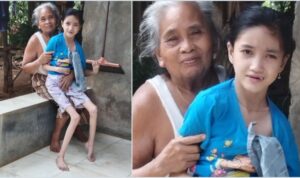 Ironis! Kasihan :( Remaja Tak Sekolah di Jateng Alami Gizi Buruk, Tubuh Kerempeng seperti Tak Berdaging