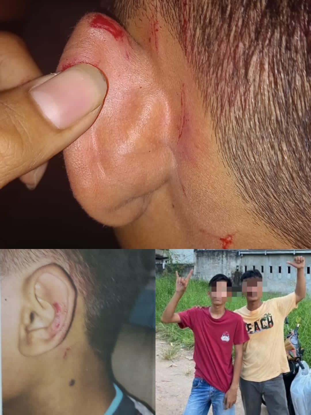 Korban dugaan penganiayaan terhadap Anak hingga mengalami luka robek ditelinga kiri, Terlapor R (kaos merah adik) yang didampingi Tersangka B (kaos kuning kakak). (fto.ist.yn)