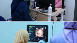 Skrining Stunting dalam Kehamilan dalam rangka HUT Provinsi Sumatera Selatan yang Ke-79