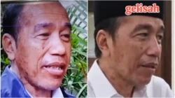 Wajah Jokowi Disorot warganet, Terlihat Kusam dan Penuh Flek, Tanda Stres atau Efek Obat-obatan?