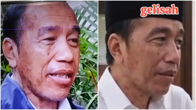 Wajah Jokowi Disorot warganet, Terlihat Kusam dan Penuh Flek, Tanda Stres atau Efek Obat-obatan?