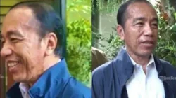 Heboh Jokowi Sakit Kulit, Dokter Tifa: Autoimun atau Hiperkortisolisme?