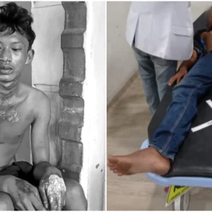 Tragis! Remaja Dibakar Hidup- hidup Usai Curi Ubi, Oknum Brimob dan ASN Jadi Tersangka