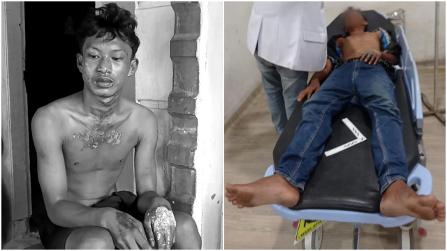 Tragis! Remaja Dibakar Hidup- hidup Usai Curi Ubi, Oknum Brimob dan ASN Jadi Tersangka